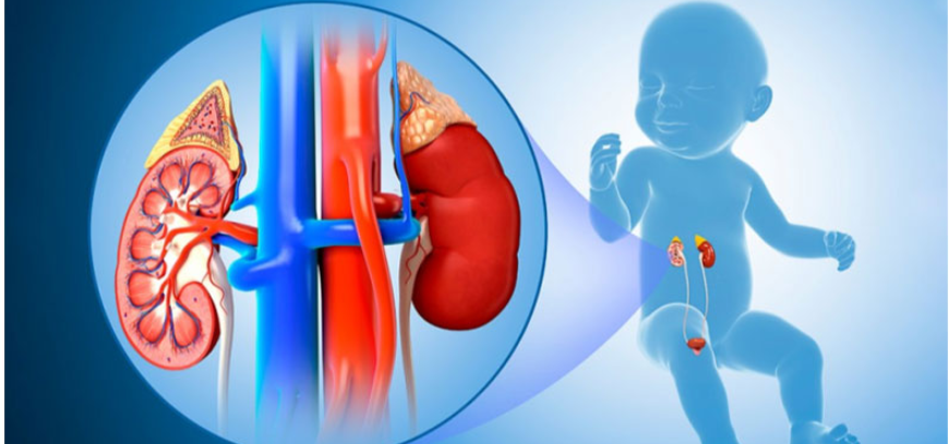Ovarian Cysts